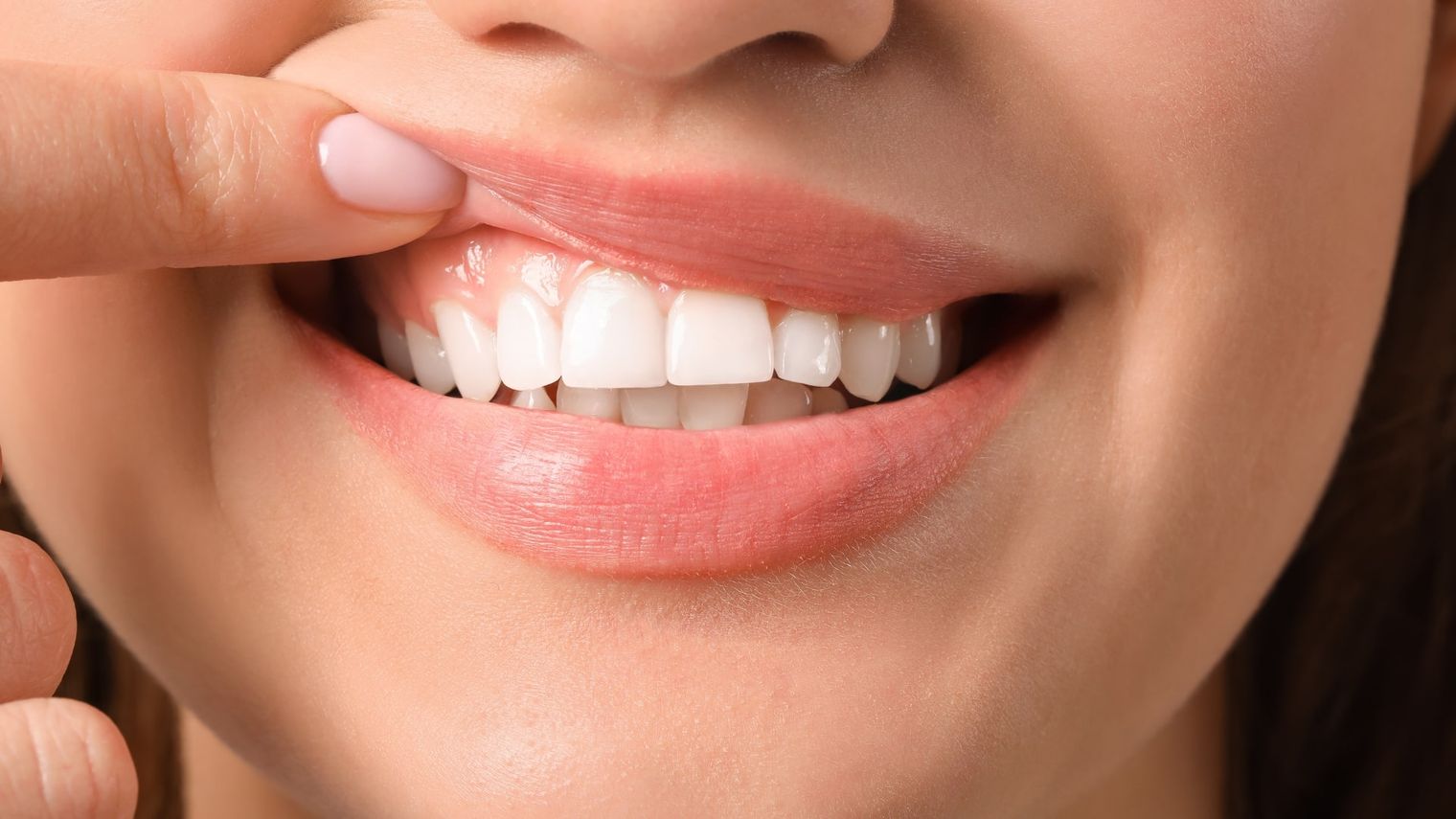 Close up of white teeth